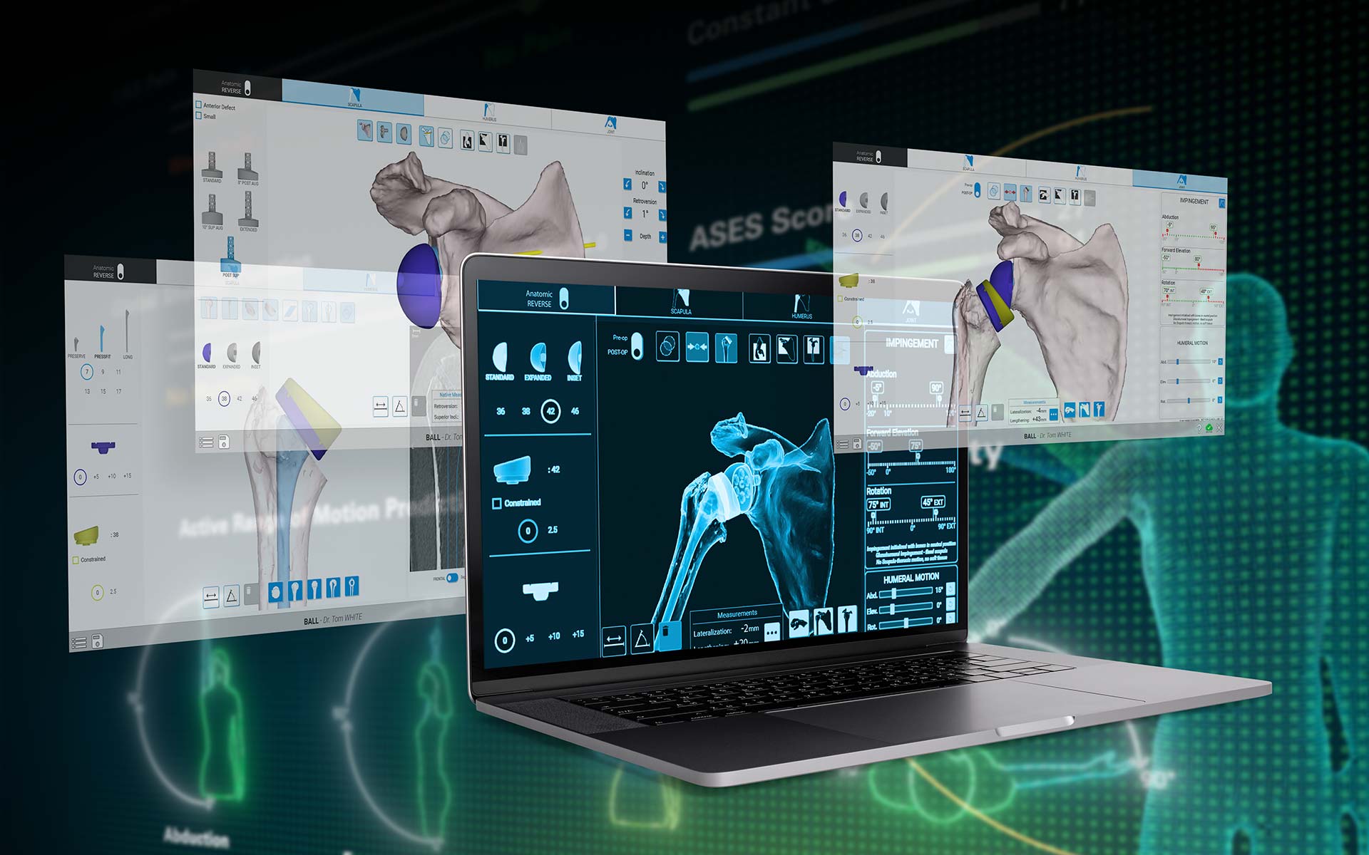 Schulter-Planungs-App