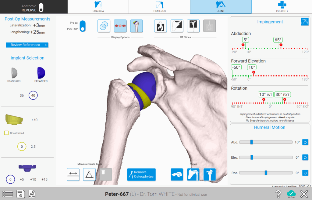 Gelenkplanung (Joint Planning)