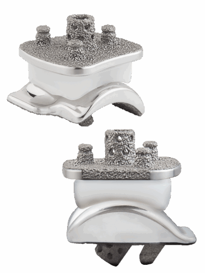 Advita Vantage Totales Sprunggelenkprothesensystem